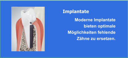 Implantate und Implantologie