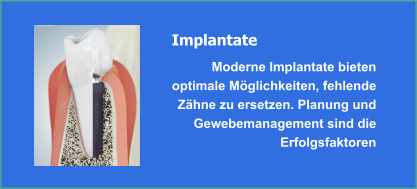 Implantate und Implantologie
