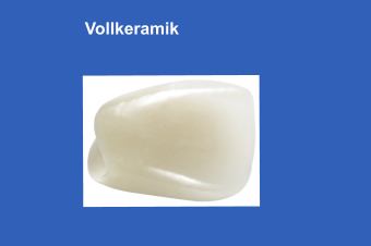 Vollkeramik
