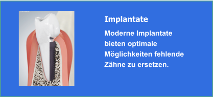 Implantate und Implantologie