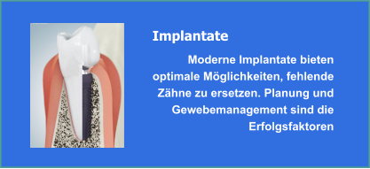 Implantate und Implantologie