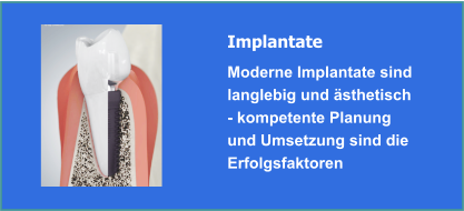 Implantate und Implantologie