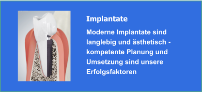Implantate und Implantologie