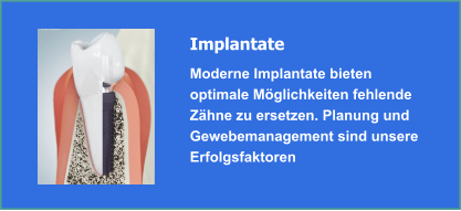 Implantate und Implantologie